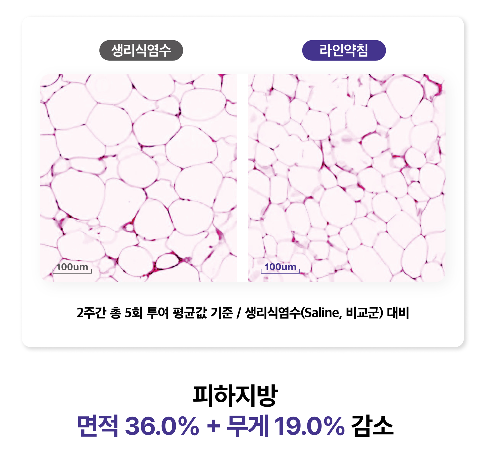 ㅇㅇㅇ