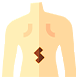 허리디스크
